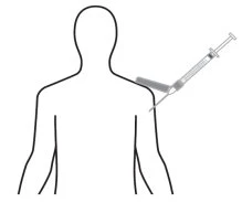 Schematic drawing of a human torso showing a syringe being inserted into the shoulder muscle at a 45-degree angle