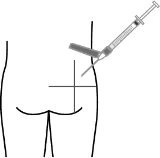 Medical diagram showing a syringe with needle approaching the gluteal muscle for an intramuscular injection