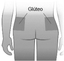 Medical diagram showing the back of a human torso with two dark rectangular areas highlighted on the buttocks labeled Gluteus