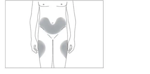 Schema stilizzato di un corpo umano con aree grigie che indicano la zona dell'iniezione
