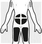 Schema del corpo umano con aree scure che indicano i siti di iniezione sulle braccia, sull'addome e sulle cosce