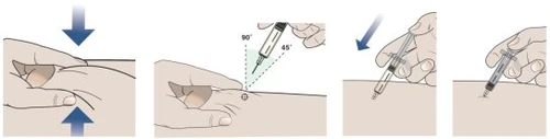 Sequence of four illustrations showing how to pinch the skin and insert a needle at a 90 or 45 degree angle for an injection