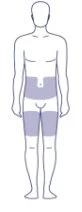 Schematic of a male human body with gray shaded areas on