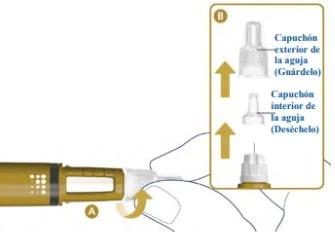 Medical diagram showing removal of the outer and inner cap of the