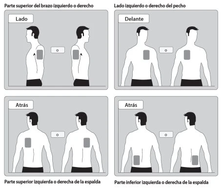Diagramma medico con quattro riquadri che mostrano figure umane stilizzate per indicare i siti di iniezione su braccio, petto e schiena