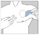 Disegno schematico di un torso maschile con una mano che applica una medicazione blu su un