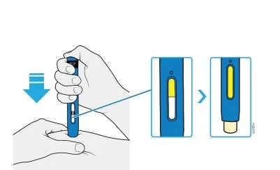 Illustrazione medica che mostra una mano che preme un dispositivo blu su una superficie con un dettaglio del livello del liquido giallo che scende