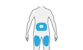 Diagramma di un corpo umano stilizzato con aree blu evidenziate su