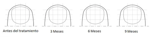 Quattro diagrammi lineari che mostrano l