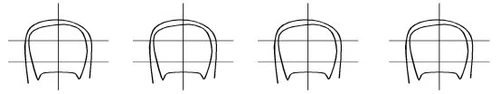 Four identical black-and-white schematic diagrams showing a cross-section of an organ with horizontal and vertical reference lines