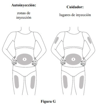 Diagramma con due figure femminili che indicano le zone di iniezione sul corpo