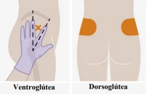 Diagramma medico che mostra due zone per iniezioni intramuscolari sul gluteo: ventroglutea con indicazione di angolazione e dorsoglutea con aree arancioni