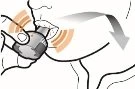 Schematic drawing showing a hand pressing a medical device against the cheek with an arrow indicating downward movement