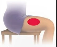 Medical illustration of a person sitting on a stool with a circular red mark on the left thigh