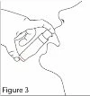 Disegno a linee nere che mostra una mano che tiene un dispositivo medico vicino al profilo del viso di una persona
