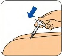 Una mano impugna una penna iniettiva per inserirla nella parte superiore della coscia con una freccia blu che indica la direzione dell'iniezione