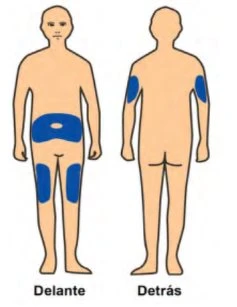 Figure stilizzate di un corpo umano viste di fronte e di dietro con aree blu su addome, cosce, braccia e parte superiore della schiena