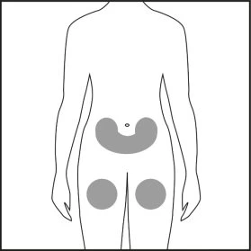 Schematic of the human torso with three gray areas indicating injection sites on the body