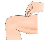 One hand holds a small medical applicator and presses it onto the skin of the upper thigh of a person