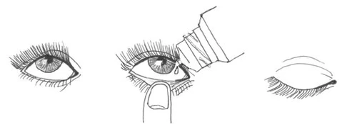 Black and white drawing showing three stages: eyes open, an eye drop falling into the eye