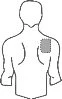 Schematic drawing of a man's torso with a rectangular patch applied on the upper left shoulder