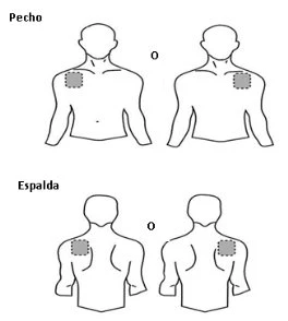 Medical diagram with four stylized human figures showing shaded areas on the chest and back to indicate injection sites