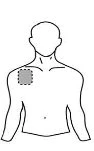 Schematic drawing of the upper body of a man with a dashed circle indicating the drug application site on the upper right shoulder