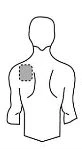 Stylized drawing of a person's torso with a dashed circle indicating the application site on the upper left back