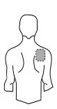 Stylized diagram of a man's torso viewed from behind, with a gray circle indicating the position of a patch on the upper back