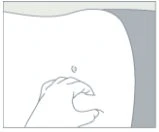 Stylized drawing of a hand pinching the skin