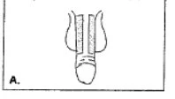 Black and white schematic drawing showing a cross-section of an organ with two parallel vertical channels and a rounded base