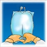 Medical diagram showing two hands pressing the base of a suspended blue infusion bag against a light blue background