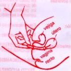 Anatomical diagram in red showing the position of the bladder, of the