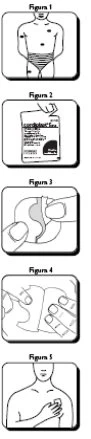 Series of five medical diagrams showing a body with rashes, a drug package, and the