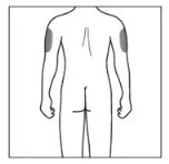 Disegno schematico del corpo umano visto di schiena con due aree grigie evidenziate sulla parte superiore esterna di entrambe le braccia