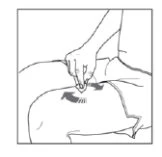 Line drawing of a hand pressing a medical device against the upper part of the abdomen