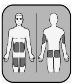 Diagramma medico che mostra un corpo umano visto di fronte e di schiena con aree grigie evidenziate sull'
