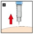 Illustrazione medica di una siringa con ago puntato verso la pelle con una freccia rossa rivolta verso l