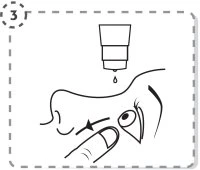 Schematic drawing showing a drop of liquid falling from a bottle onto a person's face near the eye