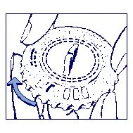 Technical drawing showing a hand rotating a circular medical device with a blue arrow indicating rotational movement to the left