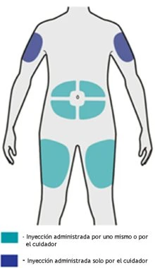 Diagramma del corpo umano con aree azzurre sulle braccia e sul torace