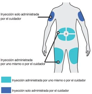Human body diagram with dark blue areas on shoulders and light blue areas on abdomen and thighs indicating drug injection sites