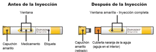 Medical diagram showing two injection stages with Dupixent, highlighting the yellow cap, drug viewing window, and label