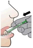 Medical illustration of a gloved hand inserting a syringe with green liquid into an open person's mouth