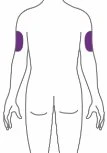 Disegno stilizzato del busto di una persona di spalle con due aree viola evidenziate sulla parte superiore di entrambe le braccia