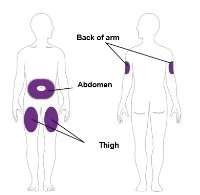 Diagramma di due sagome umane che indicano le zone di iniezione con aree viola su braccio, addome e cosce con relative etichette in inglese