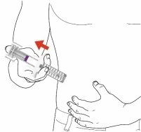 Disegno lineare di una mano che impugna una siringa per iniettare un farmaco nel tessuto adiposo dell'
