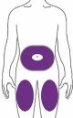 Schema del corpo umano con tre aree viola che indicano i siti di applicazione sull'