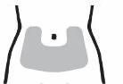 Stylized diagram of a human torso with a U-shaped gray area highlighting the