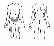 Diagramma del corpo umano frontale e posteriore con aree grigie che indicano i siti di applicazione sottocutanea